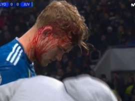 De Ligt se retiró sangrando y el Lyon marcó. Captura/MovistarLigadeCampeones