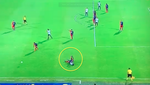 Yulian Gómez se destrozó el tobillo ante Millonarios