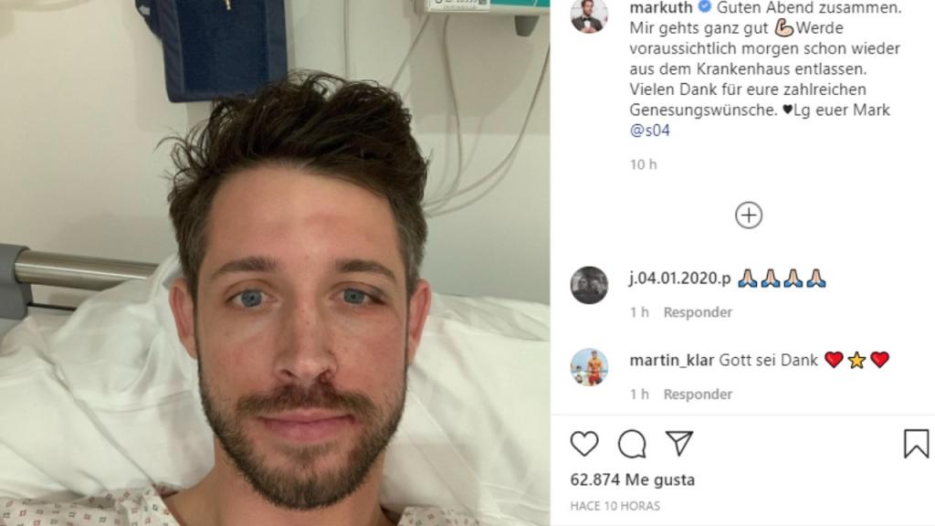 Mark Uth tranquilizó a los aficionados y espera recibir el ...