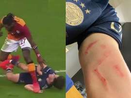 La tremenda herida de guerra del 'Clásico' turco. Capturas/Fenerbahçe